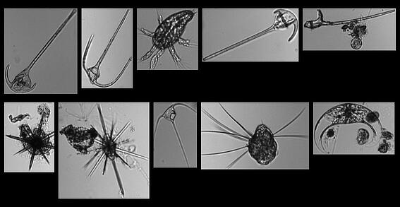 Plankton imaged by FlowCam at University College Dublin, Integrative Biology Laboratory
