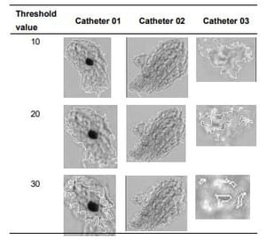 FlowCam images of protein aggregates with different threshold values