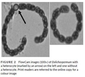 FlowCam images of Dolichospermum