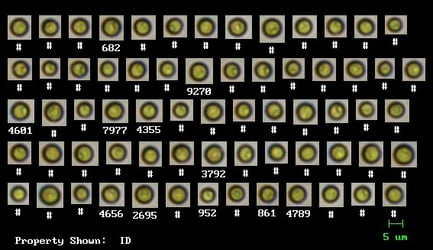 Chlorella vulgaris captured by the FlowCam at 20X