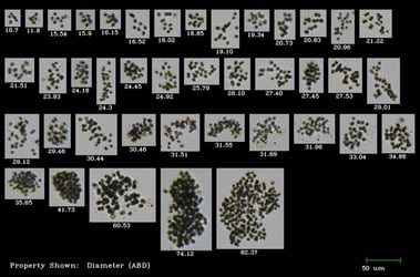 FlowCam collage of microcystis harmful algae colonies