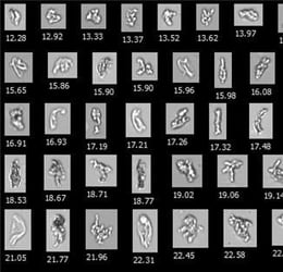 FlowCam collage of protein aggregates