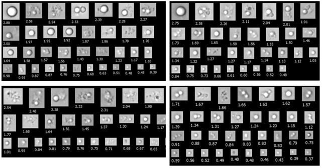 FlowCam Nano collages of extracellular vesicles