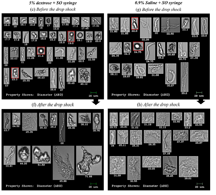 Protein Aggregates after drop shock, FlowCam Images