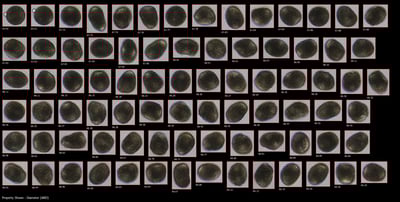 Mussel_Eggs_FlowCam_8000_