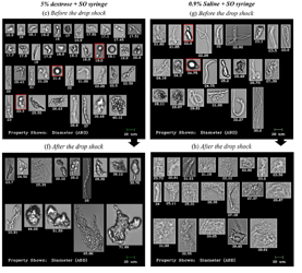 FlowCam images of IVIG proteins before and after drop shock