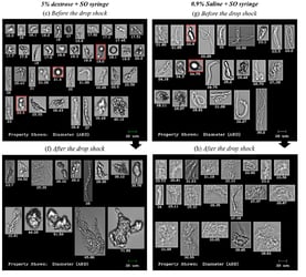 FlowCam images of IVIG proteins before and after drop shock 