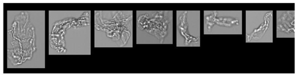 FlowCam images of particles formed in PVC IV bag filled with IVIG