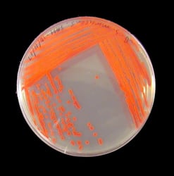 Bacteria growing in petri dish