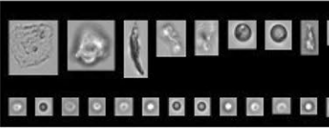 Silicone Oil and other particles as imaged by the FlowCam