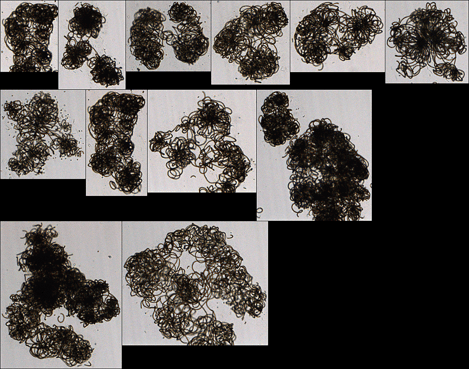 FlowCam collage of large anabaena colonies