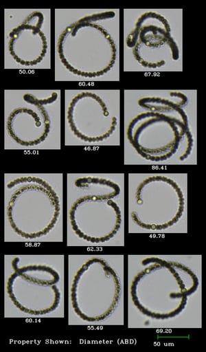 Anabaena imaged by the FlowCam