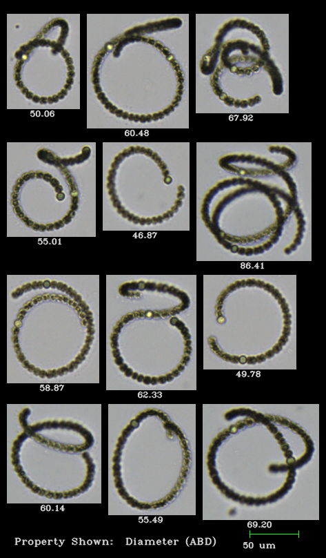 FlowCam collage of Dolichospermum cyanobacteria images