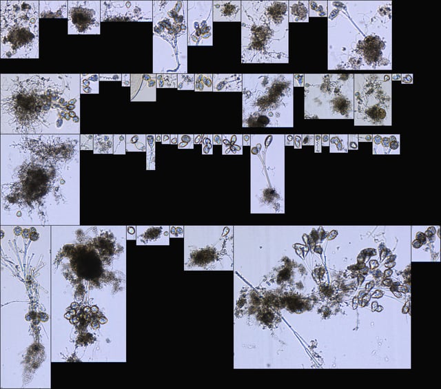 FlowCam images of wastewater stalked ciliates