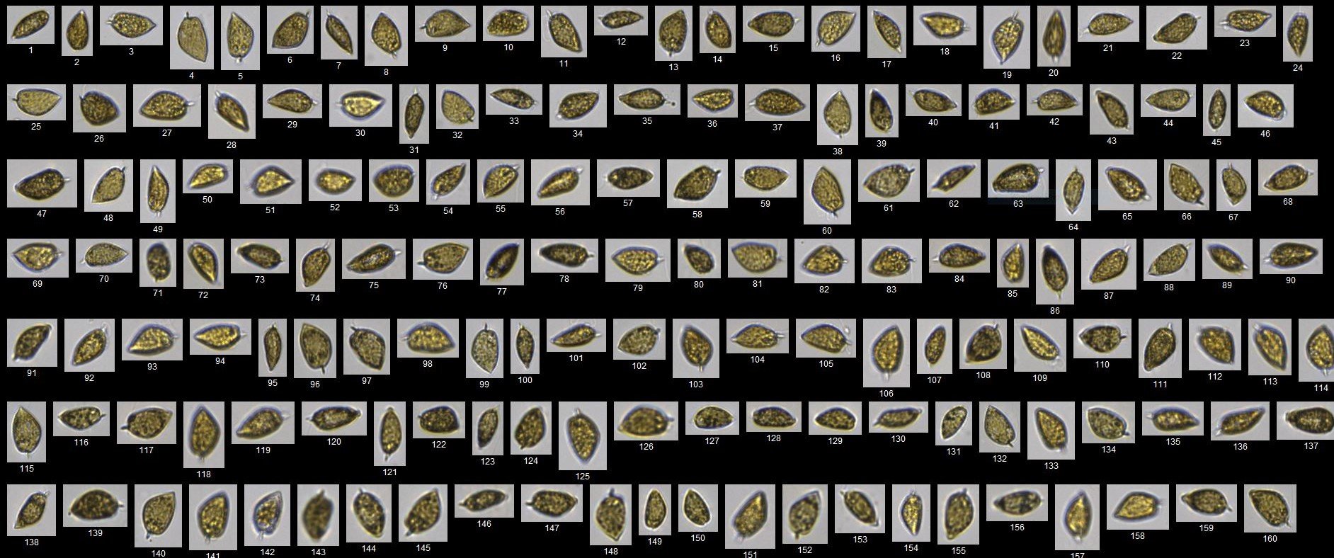 FlowCam 5000 collage of Prorocentrum micans