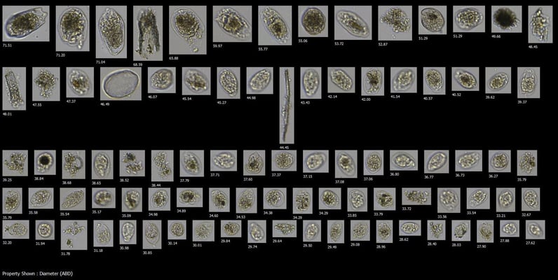 FlowCam collage of bovine rumen fluid