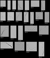 FlowCam collage of fibers