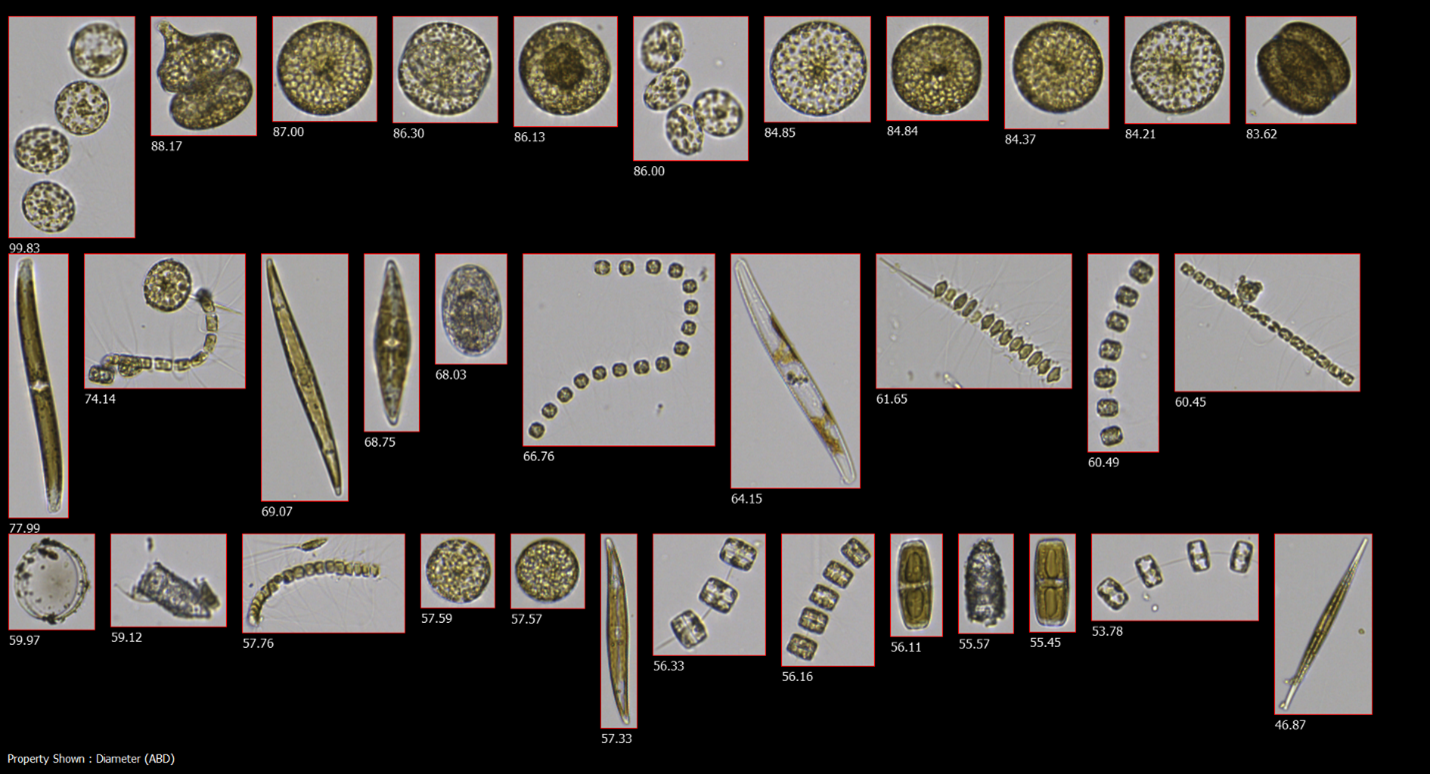 FlowCam collage of plankton collected from kelp farm