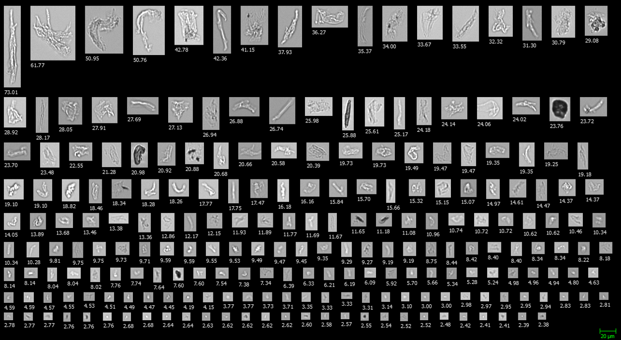 FlowCam collage of protein aggregates