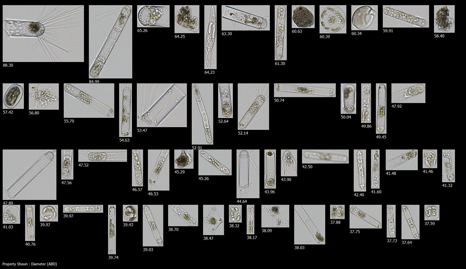 FlowCam collage phytoplankton - mostly Corethron