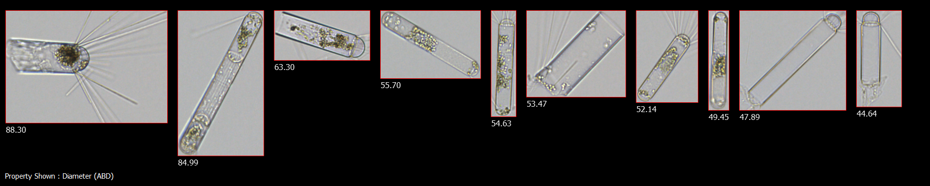 FlowCam collage of Corethron