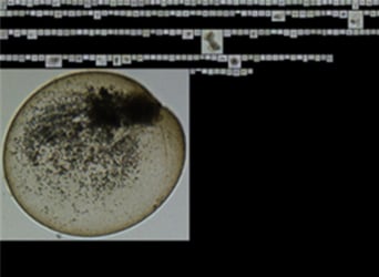 Noctiluca scintillans imaged by FlowCam showing endosymbionts
