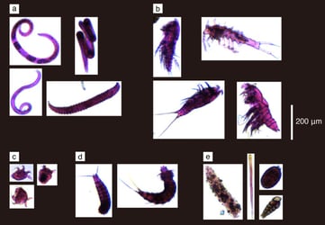 Meiobenthos meiofauna imaged by FlowCam Kitahashi et al 2018