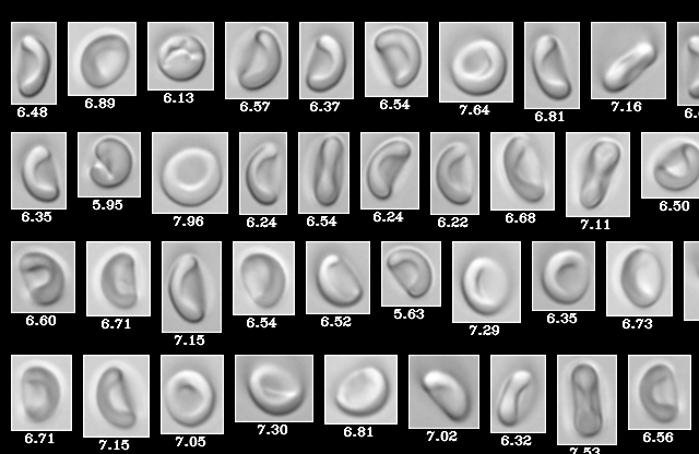 blood cells imaged by FlowCam Nano