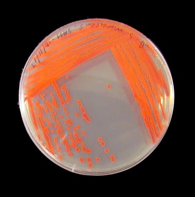 petri dish full of bright orange growth