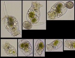 FlowCam collage of Brachionus rubens zooplankton grazers