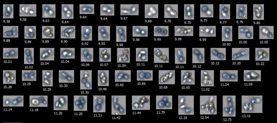 FlowCam collage of yeast cells