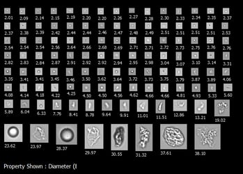 FlowCam collage of particles in biopharmaceutical sample