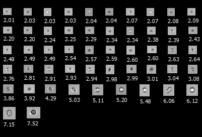 A FlowCam collage of particles in a heat-stressed LNP formulation