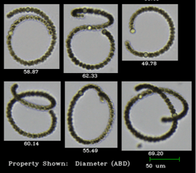 flowcam-collage-anabaena-dolichospermum-coiled-1