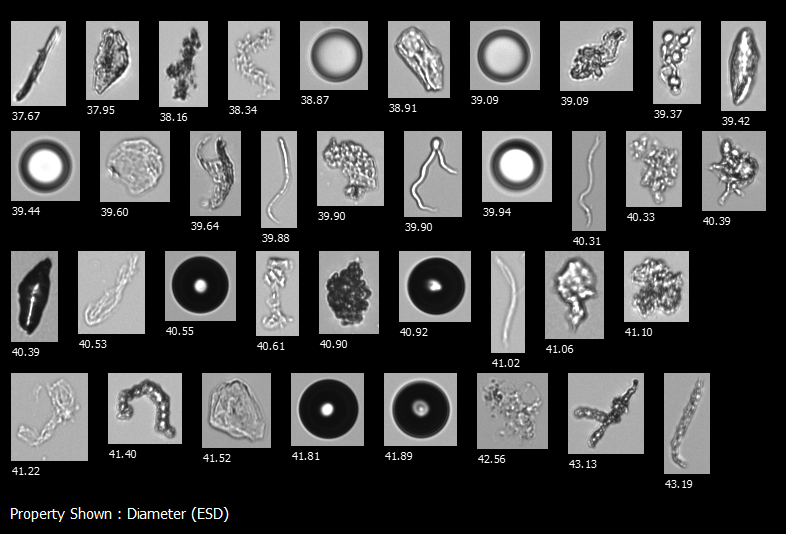 FlowCam collage of biopharmaceutical particles including protein aggregates, fibers, silicone oil droplets
