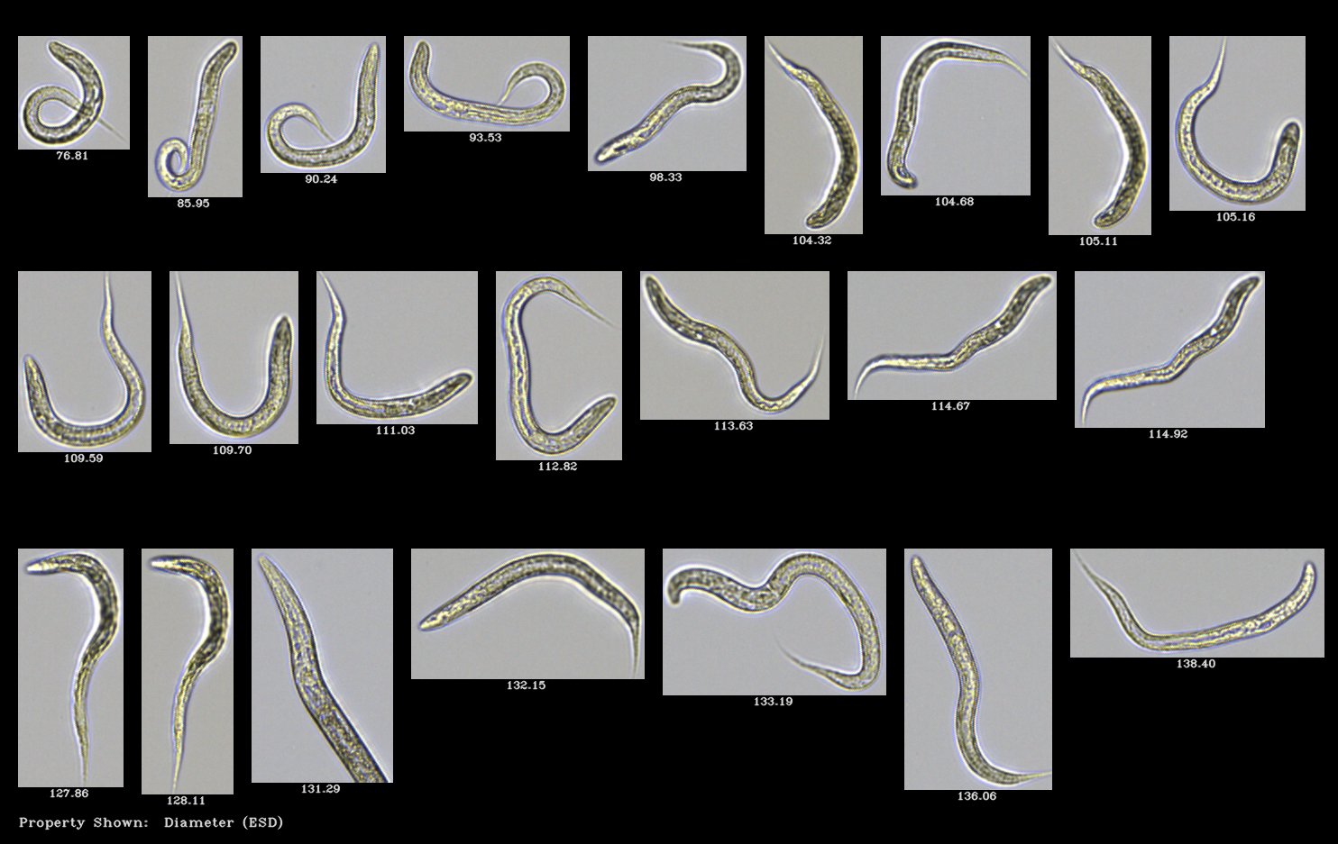 FlowCam collage of C. elegans (nematodes)
