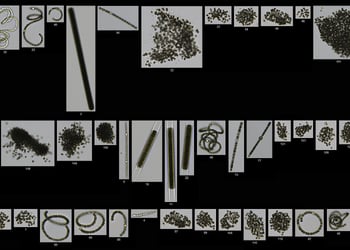 FlowCam collage of cyanobacteria including Microcystis, Anabaena, Lyngbya