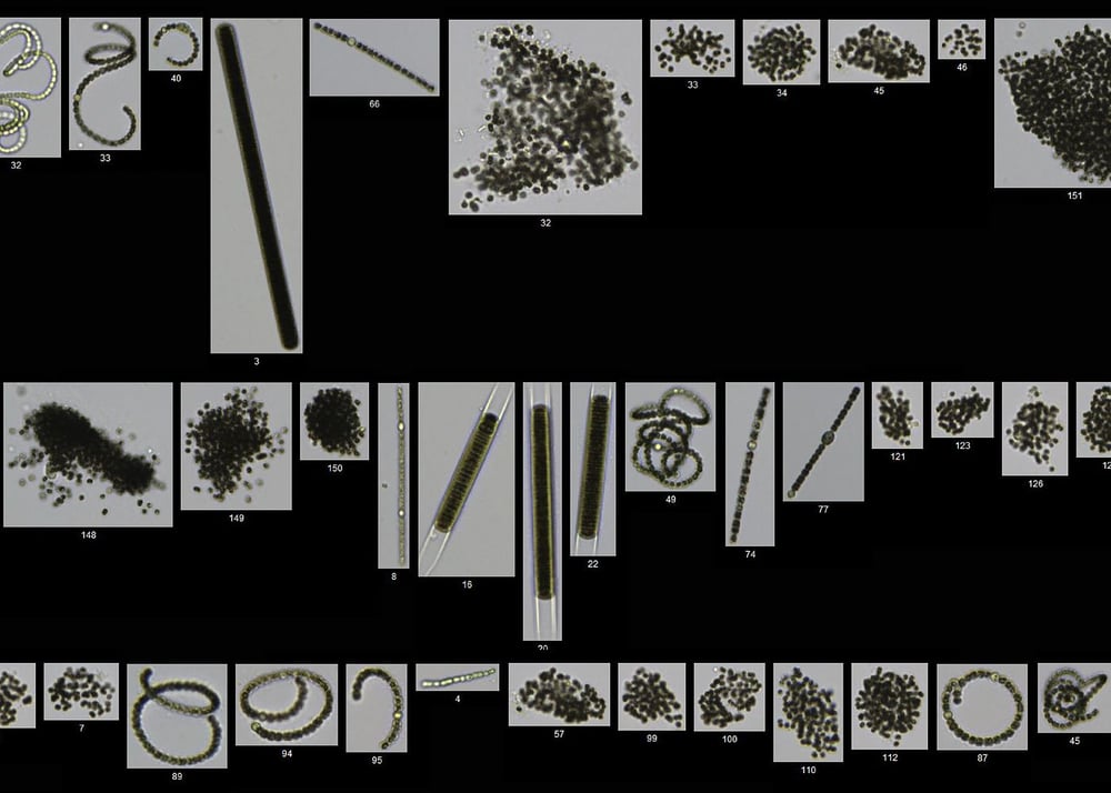 FlowCam particle collage of cyanobacteria - including microcystis, dolichospermum, lyngbya