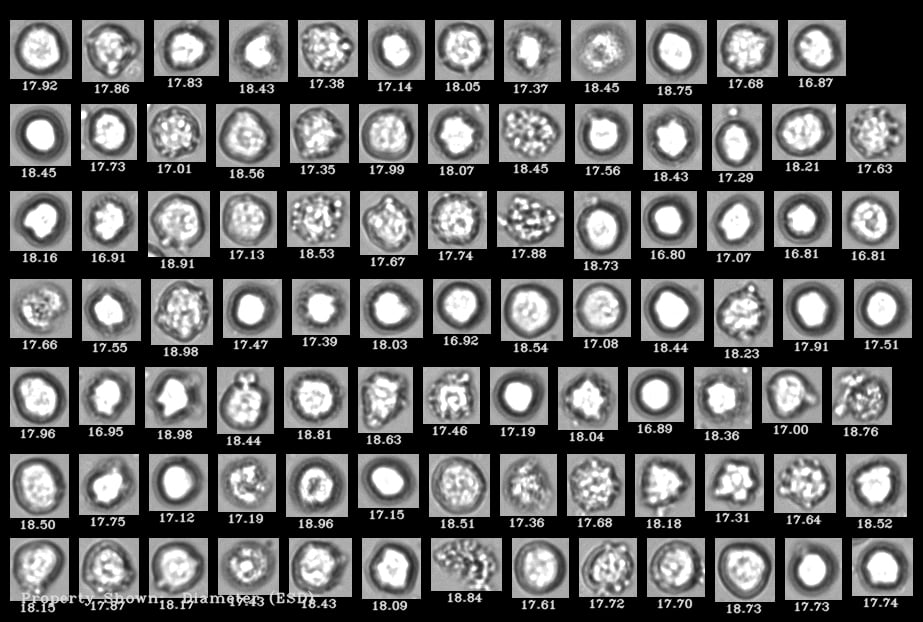 A FlowCam collage of human cells where living cells are distinguishable from dead cells.