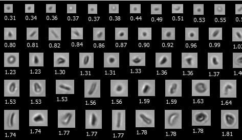 FlowCam Nano collage of semi-solid colloid particles