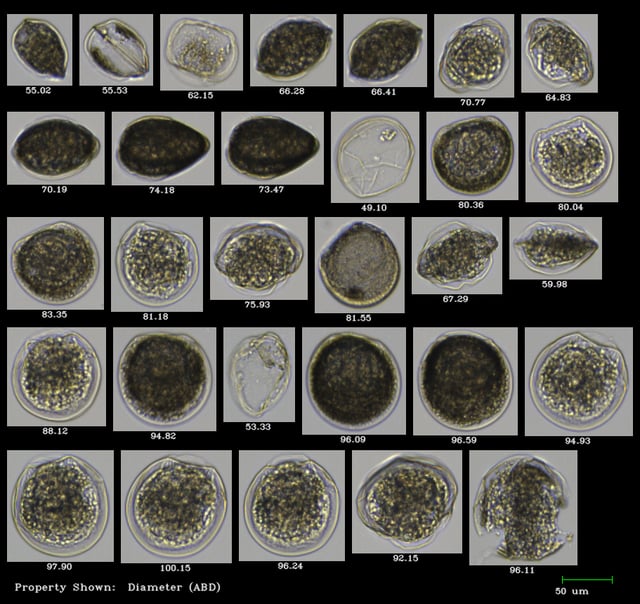 FlowCam collage of scallop spat from NOAA Milford Lab