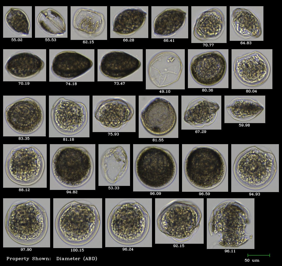 FlowCam collage of scallop spat