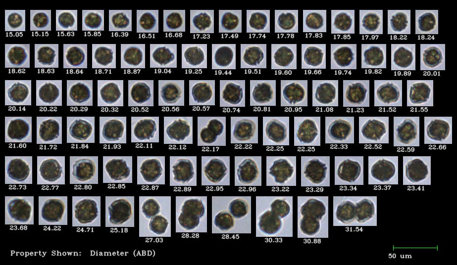 FlowCam collage phytoplankton