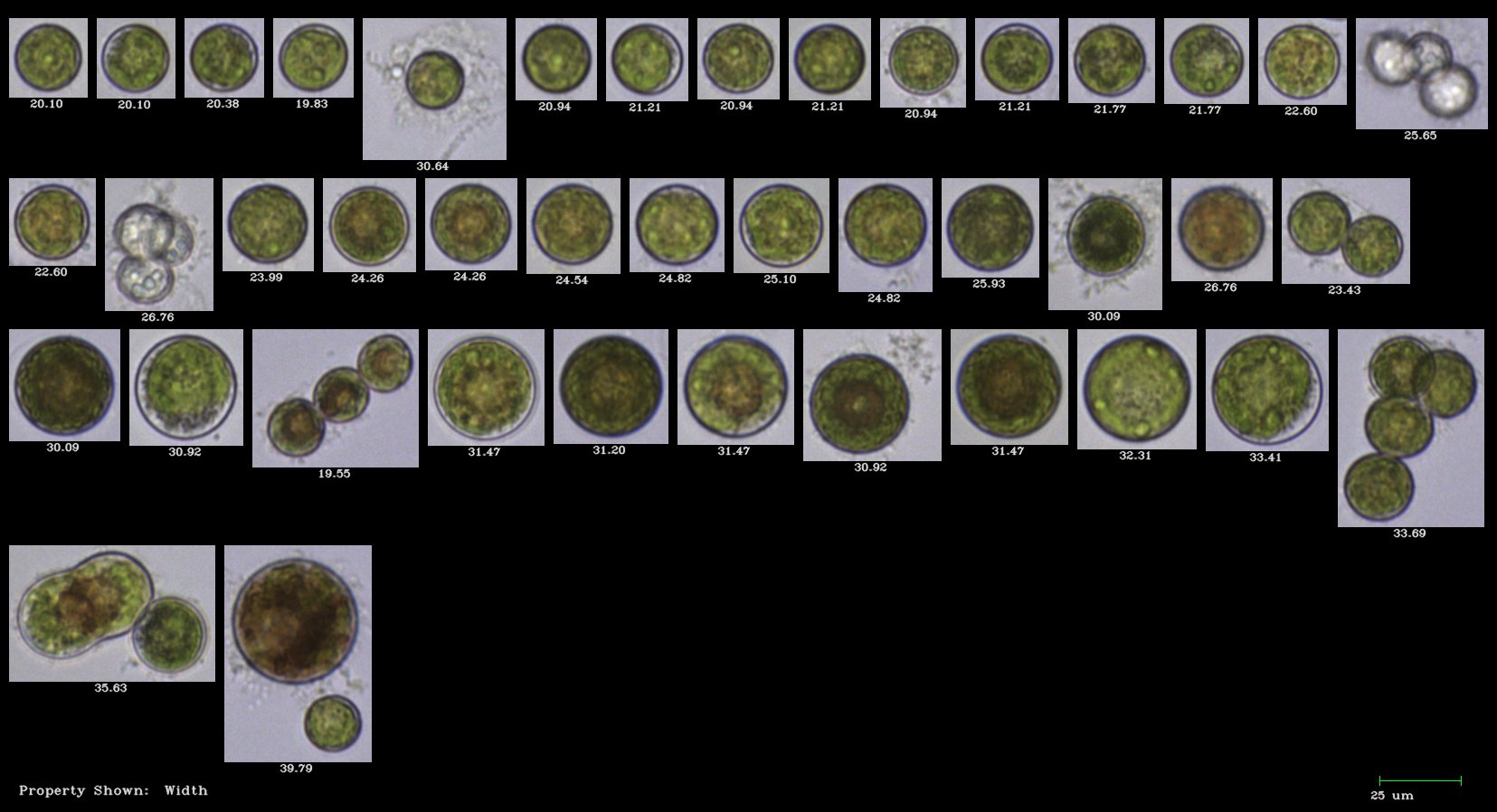 FlowCam collage algae