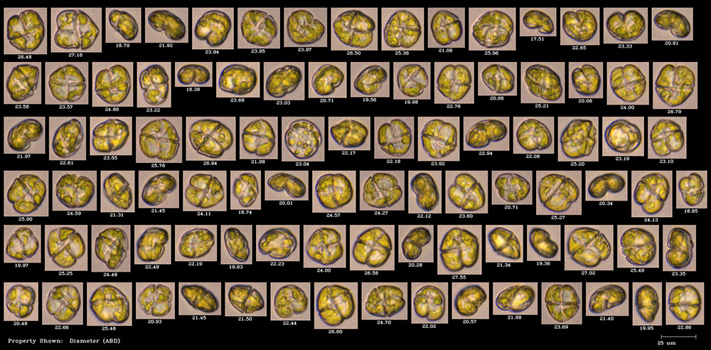 FlowCam collage of harmful algae Karenia brevis