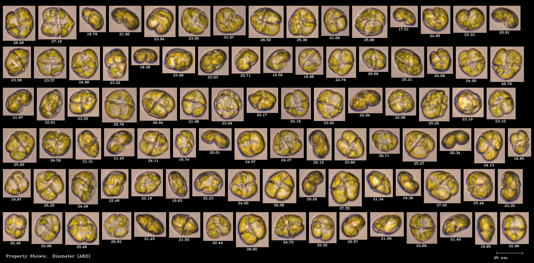 FlowCam collage phytoplankton