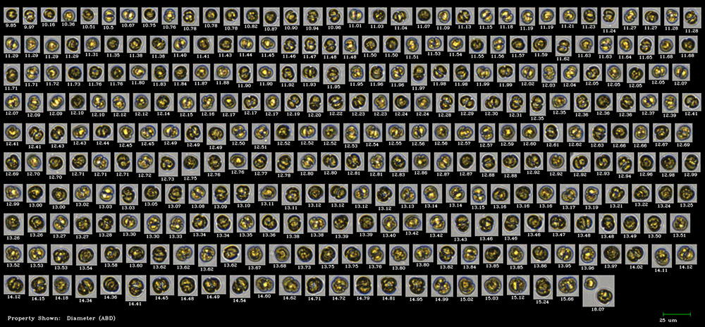 FlowCam collage of Karlodinium algae culture