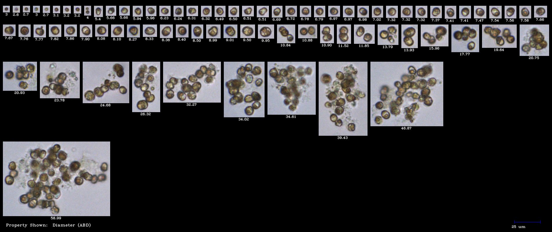 FlowCam collage of zooxanthellae algae culture