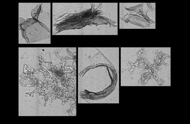 FlowCam images of juice pulp