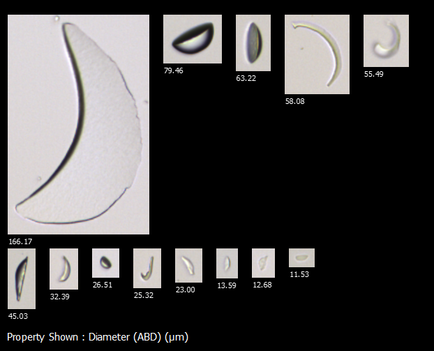 FlowCam images of slivers from tubing in single use technologies